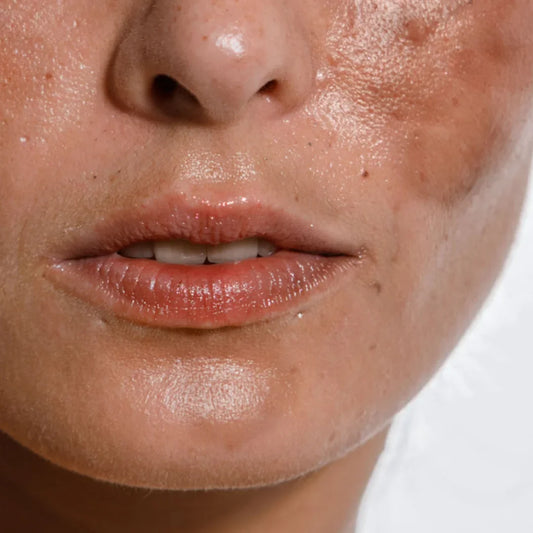 Pigmentation: Why It Happens & How to Actually Treat It