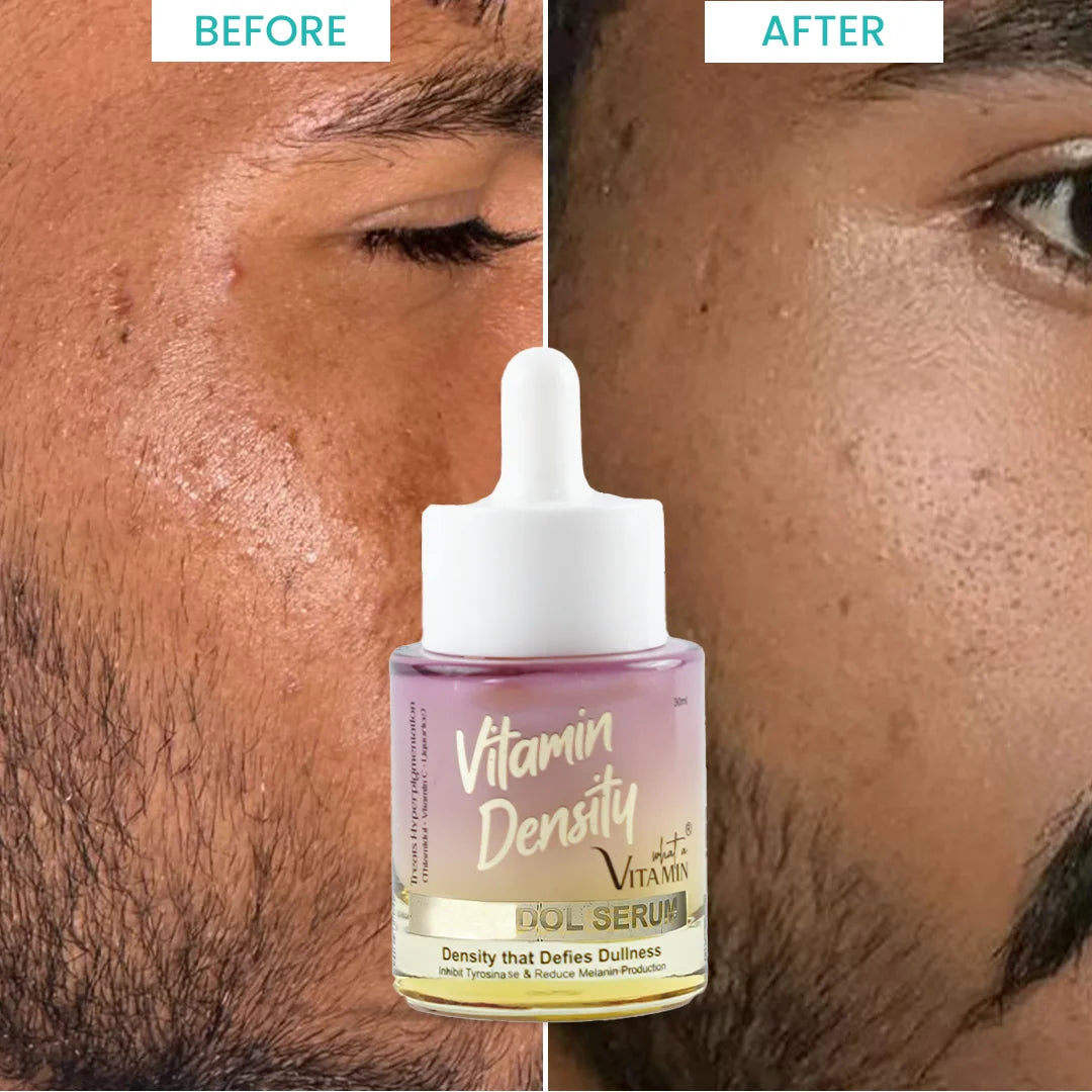 Vitamin Density